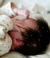 赤ちゃんの頭の画像